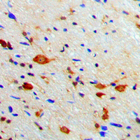 19 - Anti-PKA C beta Antibody AP51447
