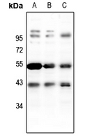 1 - Anti-PKA C beta Antibody AP51447