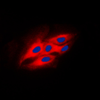 3 - Anti-Beta-glucosidase 2 Antibody AP51448