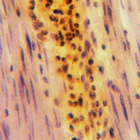 19 - Anti-Beta-glucosidase 2 Antibody AP51448