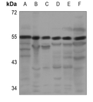 1 - Anti-PRPF19 Antibody AP51451