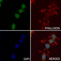 3 - Anti-PRRX1 Antibody AP51452