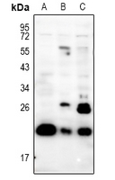 1 - Anti-PRRX1 Antibody AP51452
