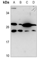 1 - Anti-PSCA Antibody AP51454