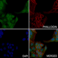 3 - Anti-Presenilin 1 Antibody AP51455