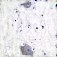 19 - Anti-Presenilin 1 Antibody AP51455