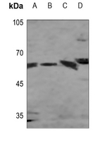 1 - Anti-Presenilin 1 Antibody AP51455