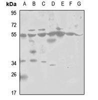 1 - Anti-PSMD12 Antibody AP51456