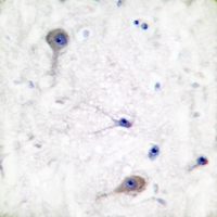19 - Anti-Patched Antibody AP51457
