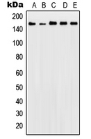 1 - Anti-Patched Antibody AP51457