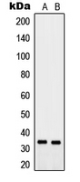 1 - Anti-PTGR2 Antibody AP51458