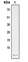 1 - Anti-PTH Antibody AP51460