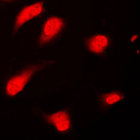 3 - Anti-PTTG1/2/3 Antibody AP51461