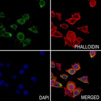 3 - Anti-RAB20 Antibody AP51462