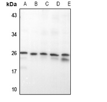 1 - Anti-RAB20 Antibody AP51462