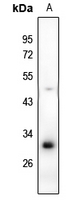 1 - Anti-RAB40B Antibody AP51463