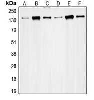 1 - Anti-RAD50 Antibody AP51464