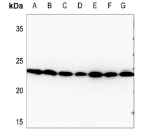 1 - Anti-RAN Antibody AP51465