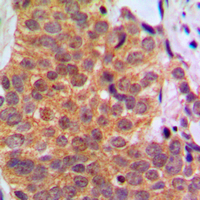 19 - Anti-RAR beta Antibody AP51466