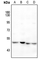1 - Anti-RAR beta Antibody AP51466