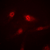 3 - Anti-RB2 Antibody AP51468