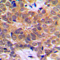 19 - Anti-RCBTB1 Antibody AP51469