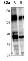 1 - Anti-RCBTB1 Antibody AP51469