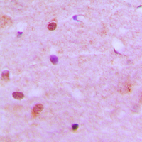 19 - Anti-RCC2 Antibody AP51470