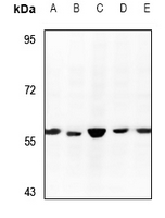 1 - Anti-RCC2 Antibody AP51470