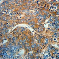 19 - Anti-Radixin Antibody AP51471