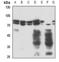 1 - Anti-Radixin Antibody AP51471