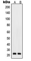 1 - Anti-RhoD Antibody AP51474