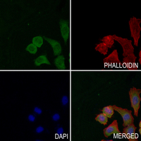 3 - Anti-RIT1 Antibody AP51476