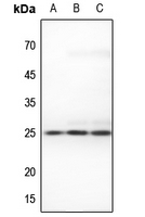 1 - Anti-RIT1 Antibody AP51476