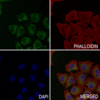 3 - Anti-RNASE3 Antibody AP51477