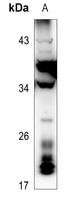 1 - Anti-RNASE3 Antibody AP51477