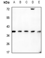 1 - Anti-RNF113B Antibody AP51478