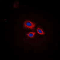3 - Anti-RNF144A Antibody AP51479