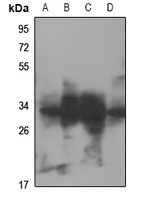 1 - Anti-RNF144A Antibody AP51479