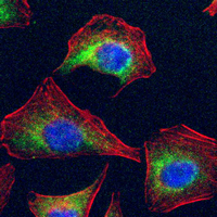 3 - Anti-ROCK1 Antibody AP51480