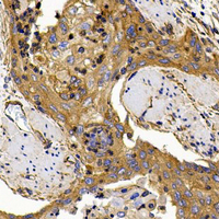 19 - Anti-ROCK1 Antibody AP51480