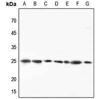 1 - Anti-RPL10 Antibody AP51481