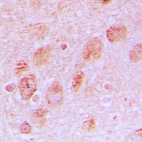 19 - Anti-RPL17 Antibody AP51482