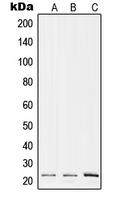 1 - Anti-RPL17 Antibody AP51482
