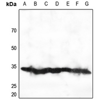 1 - Anti-RPS2 Antibody AP51489