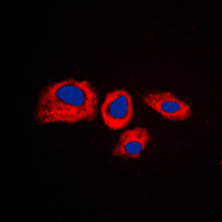 3 - Anti-RPS4Y1 Antibody AP51490