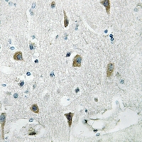 19 - Anti-RPS4Y1 Antibody AP51490