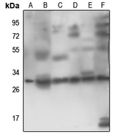 1 - Anti-RPS4Y1 Antibody AP51490