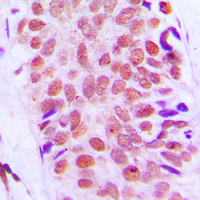 19 - Anti-RPS8 Antibody AP51491