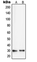 1 - Anti-RPS8 Antibody AP51491